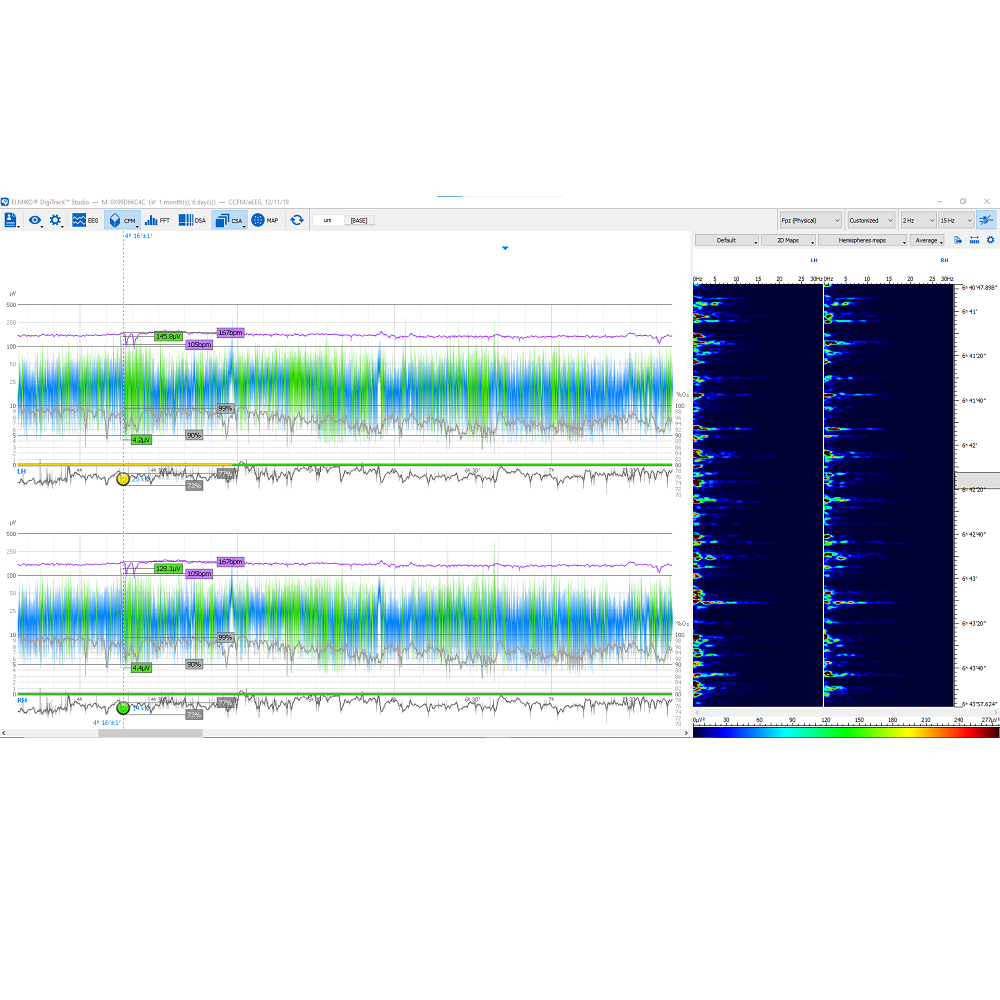 Oprogramowanie do analizy EEG ELMIKO do analizy EEG