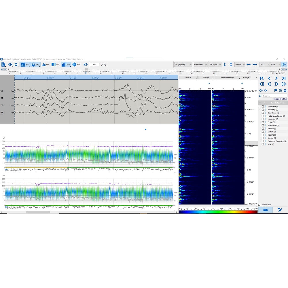 Oprogramowanie do analizy EEG ELMIKO do analizy EEG