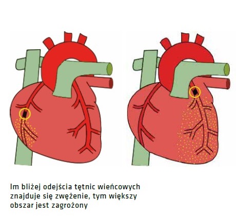 Oprogramowanie do Aparatów EKG SCHILLER CCAA