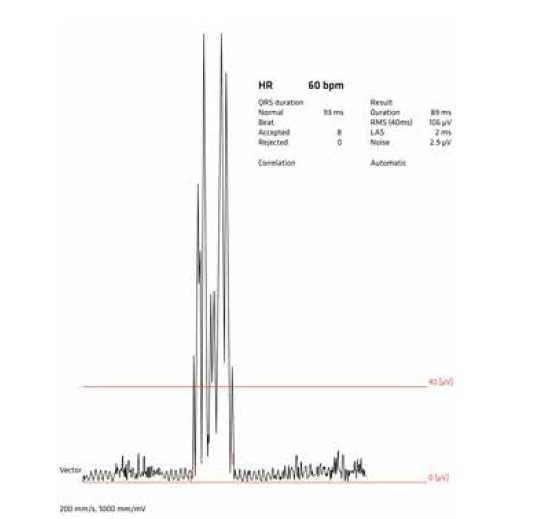 Oprogramowanie do Aparatów EKG SCHILLER SAECG