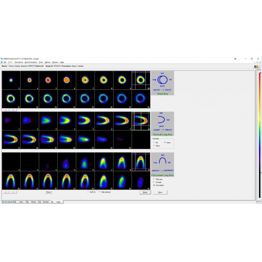 Oprogramowanie do diagnostyki obrazowej do medycyny nuklearnej Mediso Interview XP