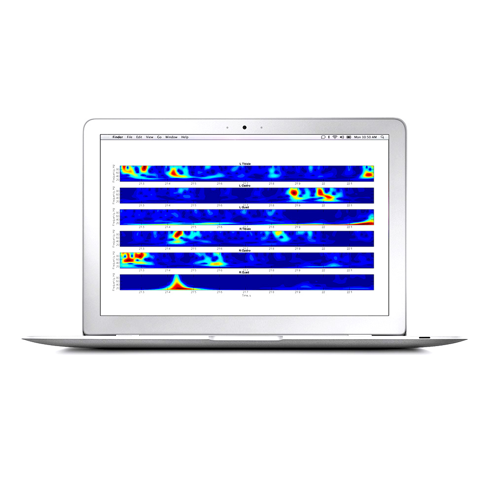 Oprogramowanie do elektromiografów (EMG) Cometa EMG Easy Report