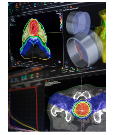 Oprogramowanie do radioterapii B/D RayStation