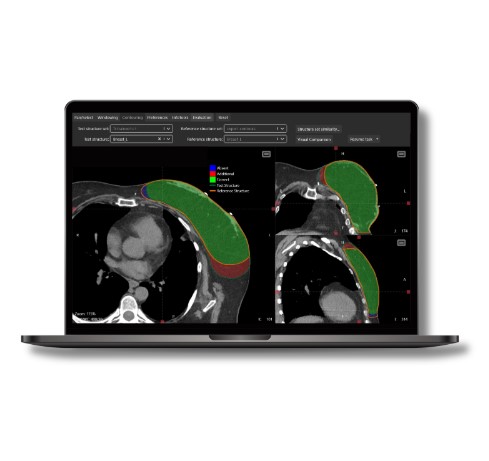 Oprogramowanie do radioterapii MVision AI Guide