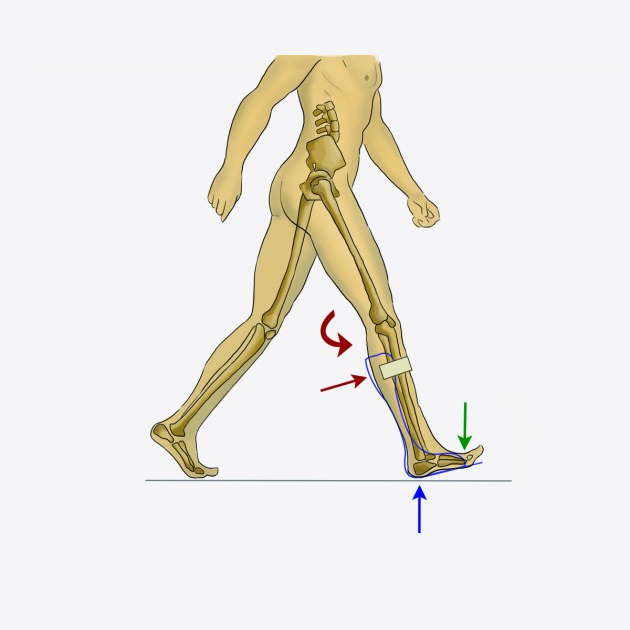 Ortezy na opadającą stopę REH4MAT AM-ASS-OS