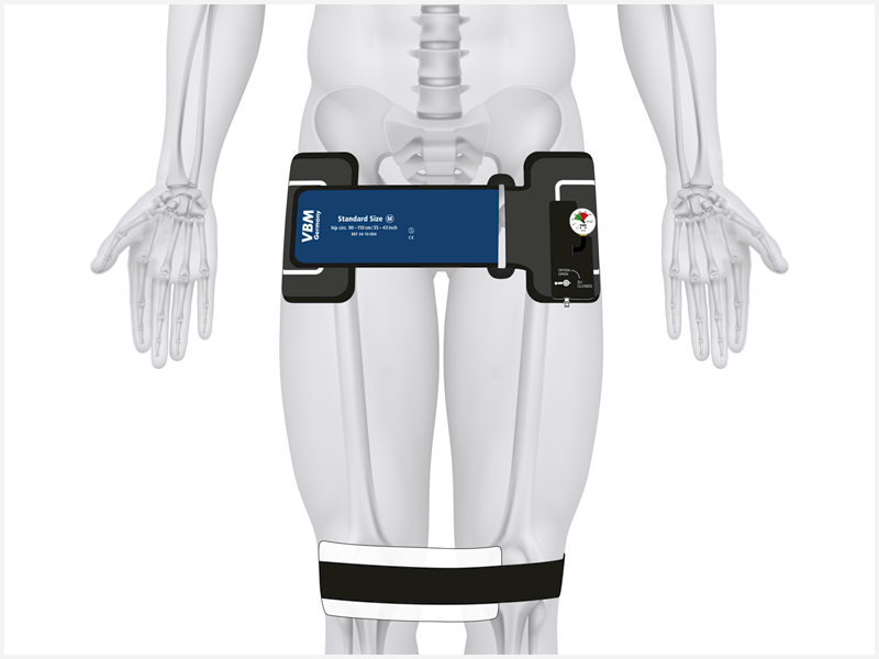 Pasy do stabilizacji złamań miednicy VBM Medizintechnik 34-10-006