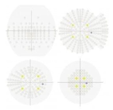 Perymetry komputerowe - polomierze FREY AP-300