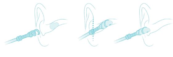 Pętle do usuwania woszczyny EARWAYS MEDICAL EarWay Pro