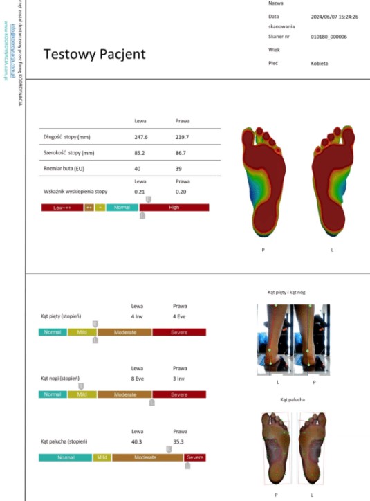 Podoskopy Koordynacja 3D Laser Foot Scaner