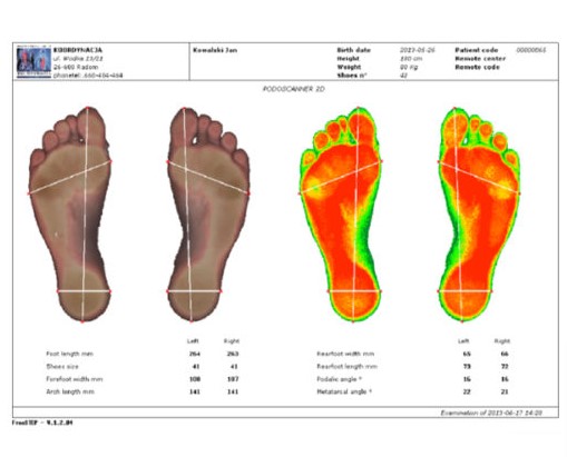 Podoskopy Koordynacja Podoscan 2D FootCAD