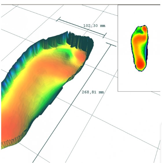 Podoskopy Koordynacja PODOSCAN3D