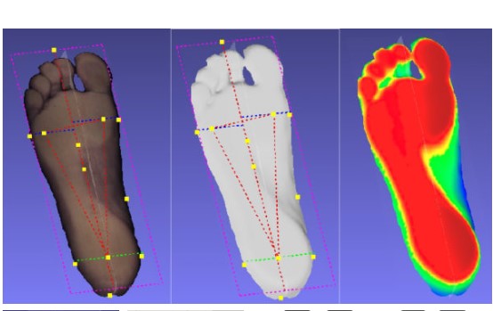 Podoskopy Koordynacja PODOSCAN3D