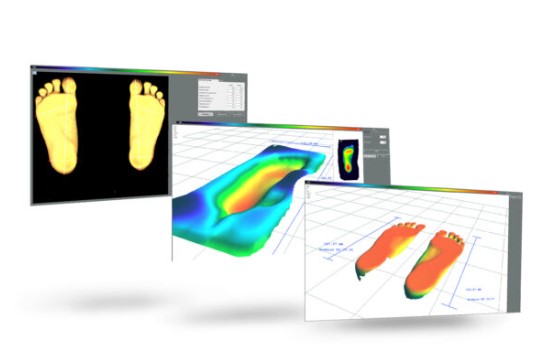 Podoskopy Koordynacja PODOSCAN3D