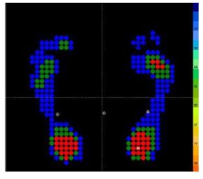 Podoskopy Namrol PD-400
