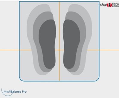 Posturografy do diagnostyki zaburzeń równowagi MediTECH Electronic MediBalance Pro