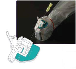 Prowadnice igieł do głowic ultrasonograficznych CIVCO Ultra-Pro 3