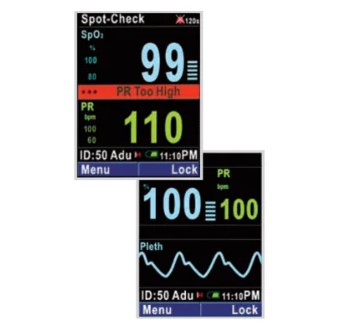 Pulsoksymetry weterynaryjne MINDRAY PM60 Vet