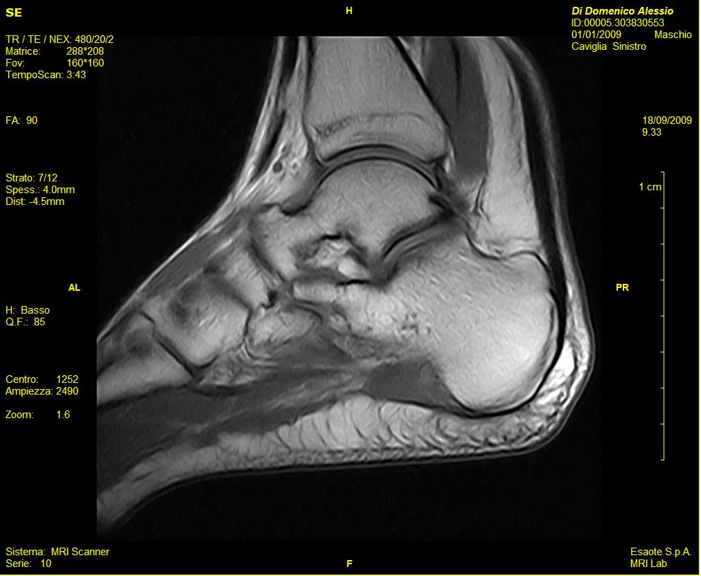 Rezonans magnetyczny (MRI) ESAOTE O-scan