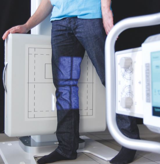 RTG kostno-płucne do radiografii Protec PRS 500 B