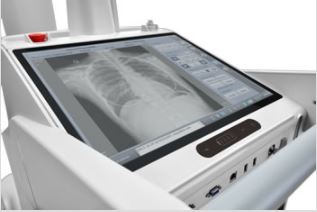 RTG przyłóżkowe i mobilne MINDRAY MobiEye 700