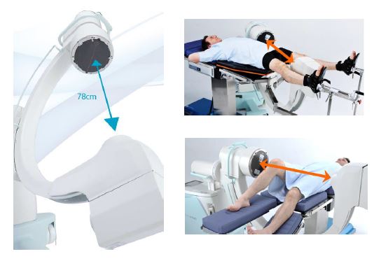 RTG śródoperacyjne (Ramię C) Shimadzu Corporation ACTENO