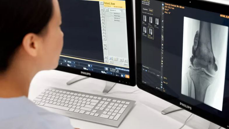 RTG zdalnie sterowane, uniwersalne do radiografii i fluoroskopii PHILIPS ProxiDiagnost N90