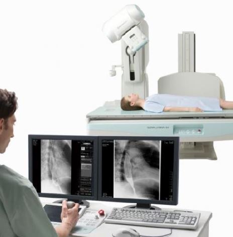 RTG zdalnie sterowane, uniwersalne do radiografii i fluoroskopii Shimadzu Corporation Sonialvision G4