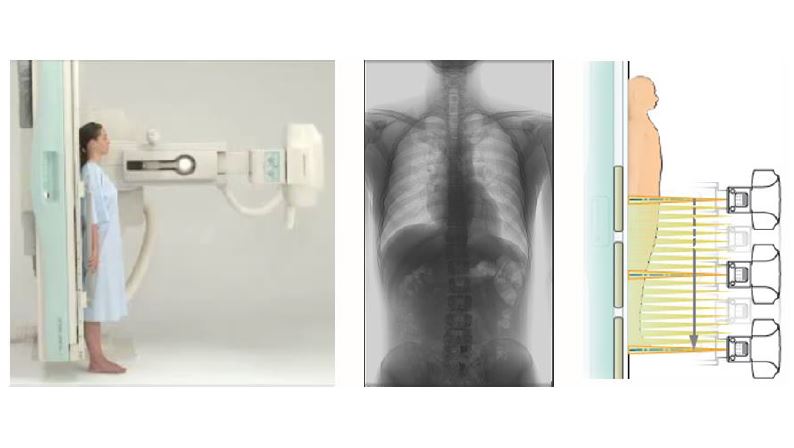 RTG zdalnie sterowane, uniwersalne do radiografii i fluoroskopii Shimadzu Corporation Sonialvision G4