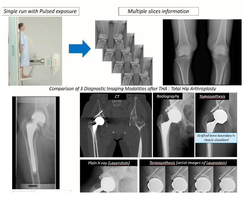 RTG zdalnie sterowane, uniwersalne do radiografii i fluoroskopii Shimadzu Corporation Sonialvision G4
