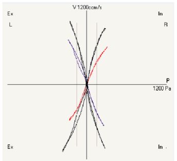 Rynomanometry Rhinolab 4RHINO