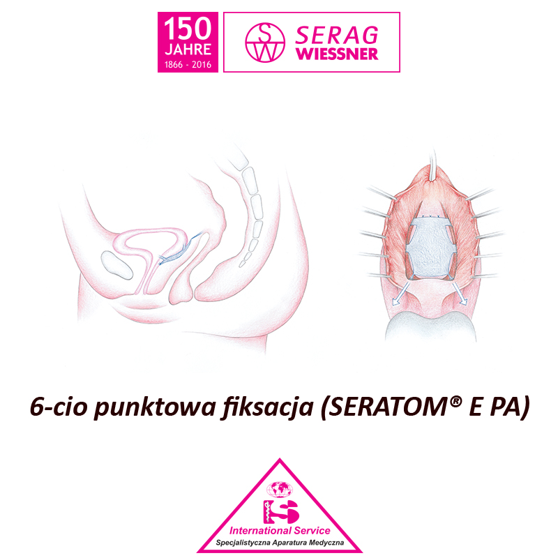 Siatki i taśmy do zabiegów urologicznych Serag Wiessner SERATOM PA