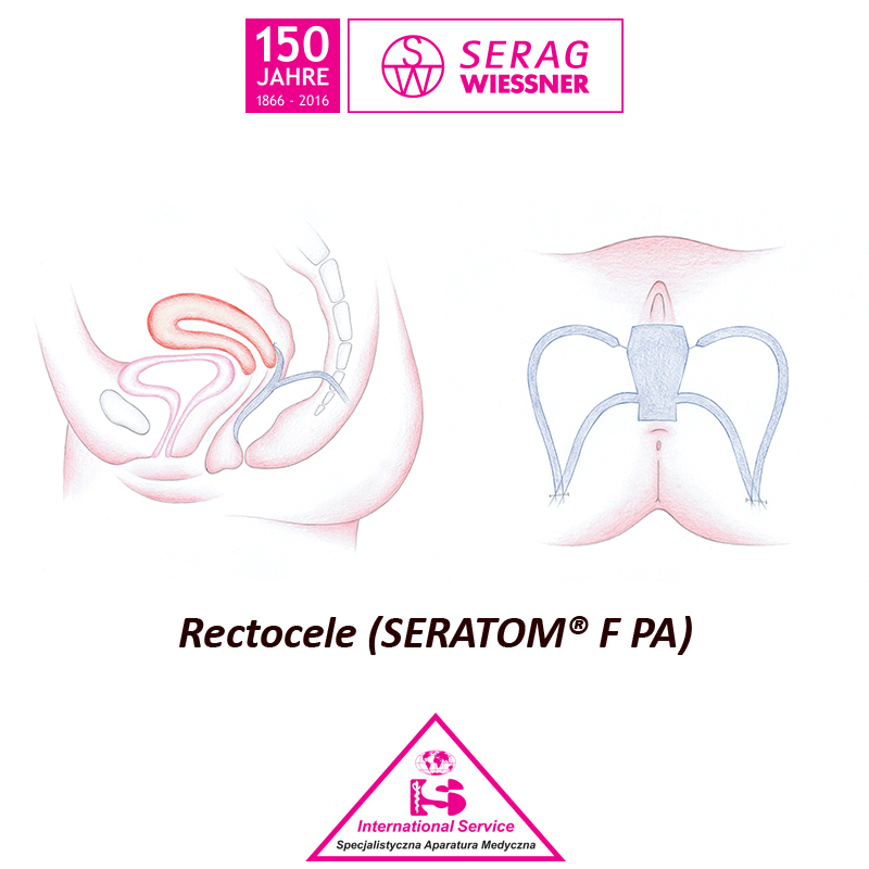 Siatki i taśmy do zabiegów urologicznych Serag Wiessner SERATOM PA