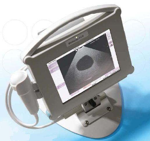 Skanery pęcherza Mediwatch Multiscan PVR