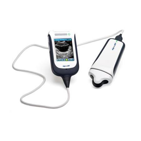 Skanery pęcherza Signostics SignosRT