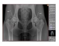 Skanery płyt obrazowych (radiografia pośrednia) OR Technology Divario CR-T2/Tm