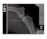 Skanery płyt obrazowych (radiografia pośrednia) OR Technology Divario CR-T2/Tm