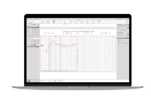 Słuchowe potencjały wywołane ABR/BERA OTODYNAMICS Ltd CELESTA