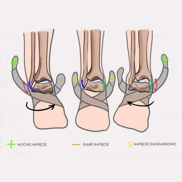 Stabilizatory stawu skokowego REH4MAT AM-OSS-05/CCA