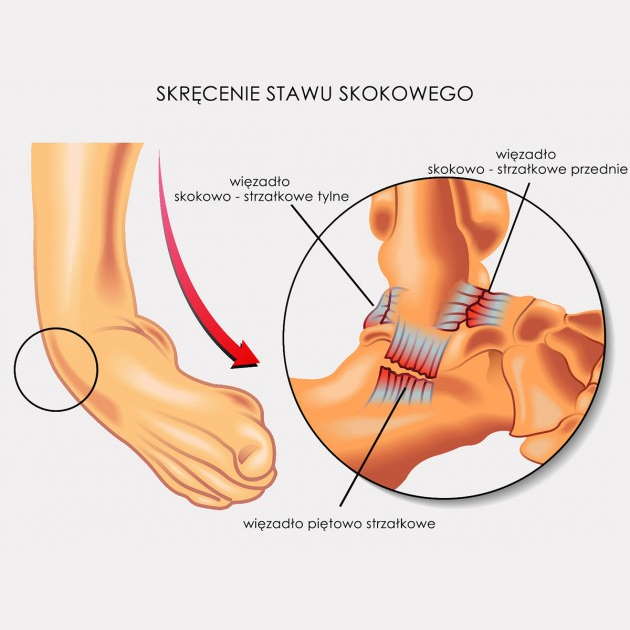 Stabilizatory stawu skokowego REH4MAT AM-SX-08