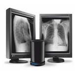 Stacje diagnostyczne obrazów medycznych Alteris Alteris X-RAY