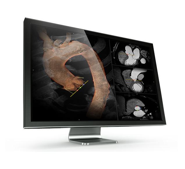 Stacje diagnostyczne obrazów medycznych Canon VITREA