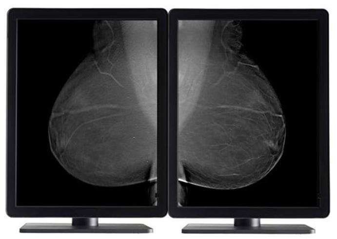 Stacje diagnostyczne obrazów medycznych IMS Stacje diagnostyczne