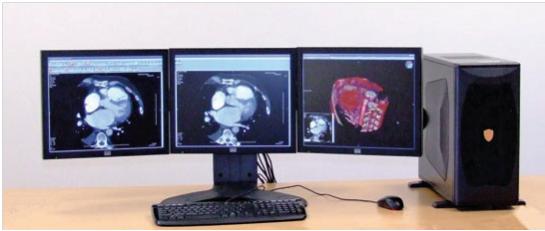 Stacje diagnostyczne obrazów medycznych KIE SPECTO CT/MR