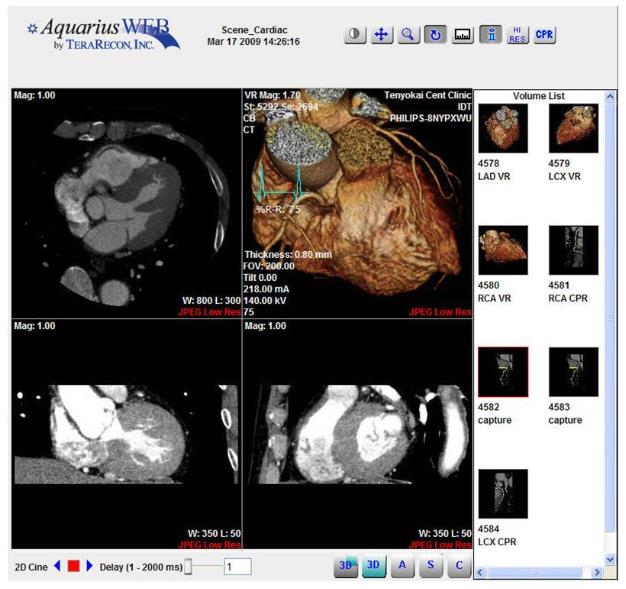 Stacje diagnostyczne obrazów medycznych TeraRecon Aquarius