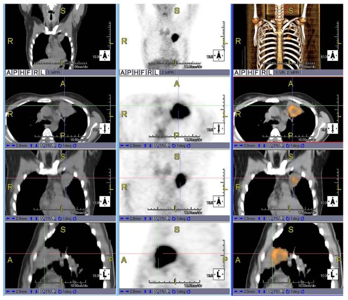 Stacje diagnostyczne obrazów medycznych TeraRecon Aquarius