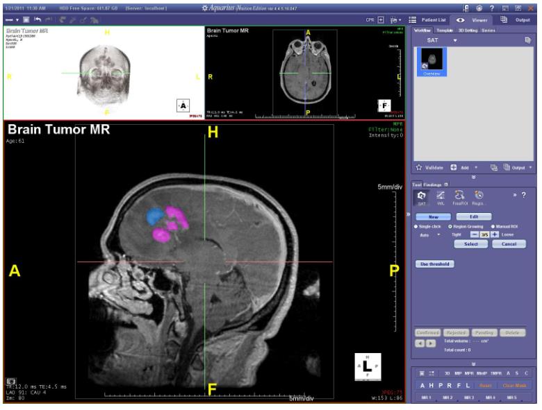 Stacje diagnostyczne obrazów medycznych TeraRecon Aquarius