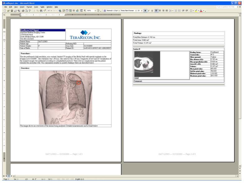 Stacje diagnostyczne obrazów medycznych TeraRecon Aquarius