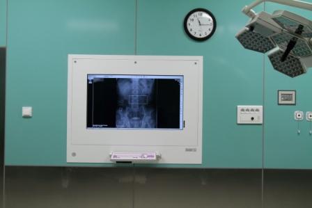 Stacje przeglądowe obrazów medycznych na sale operacyjne ULTRAVIOL DICO 1M 43" STACJA PRZEGLĄDOWA CYFROWYCH OBRAZÓW MEDYCZNYCH
