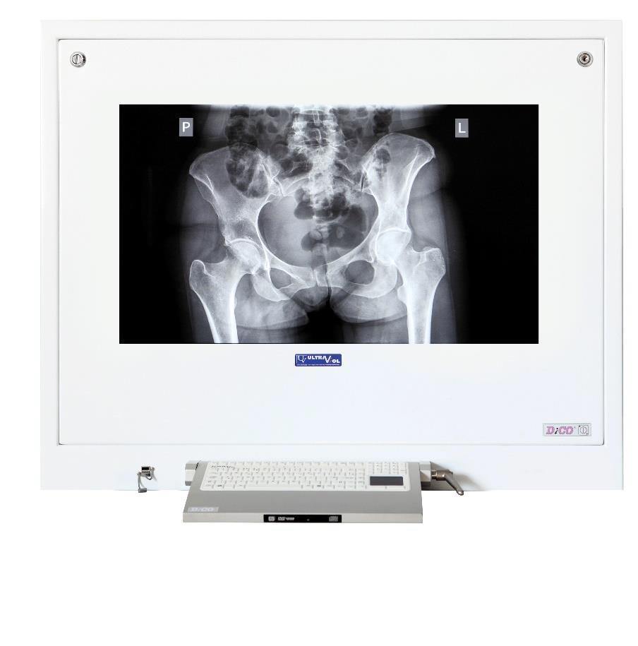 Stacje przeglądowe obrazów medycznych na sale operacyjne ULTRAVIOL DICO 1M 49" -  STACJA PRZEGLĄDOWA CYFROWYCH OBRAZÓW MEDYCZNYCH