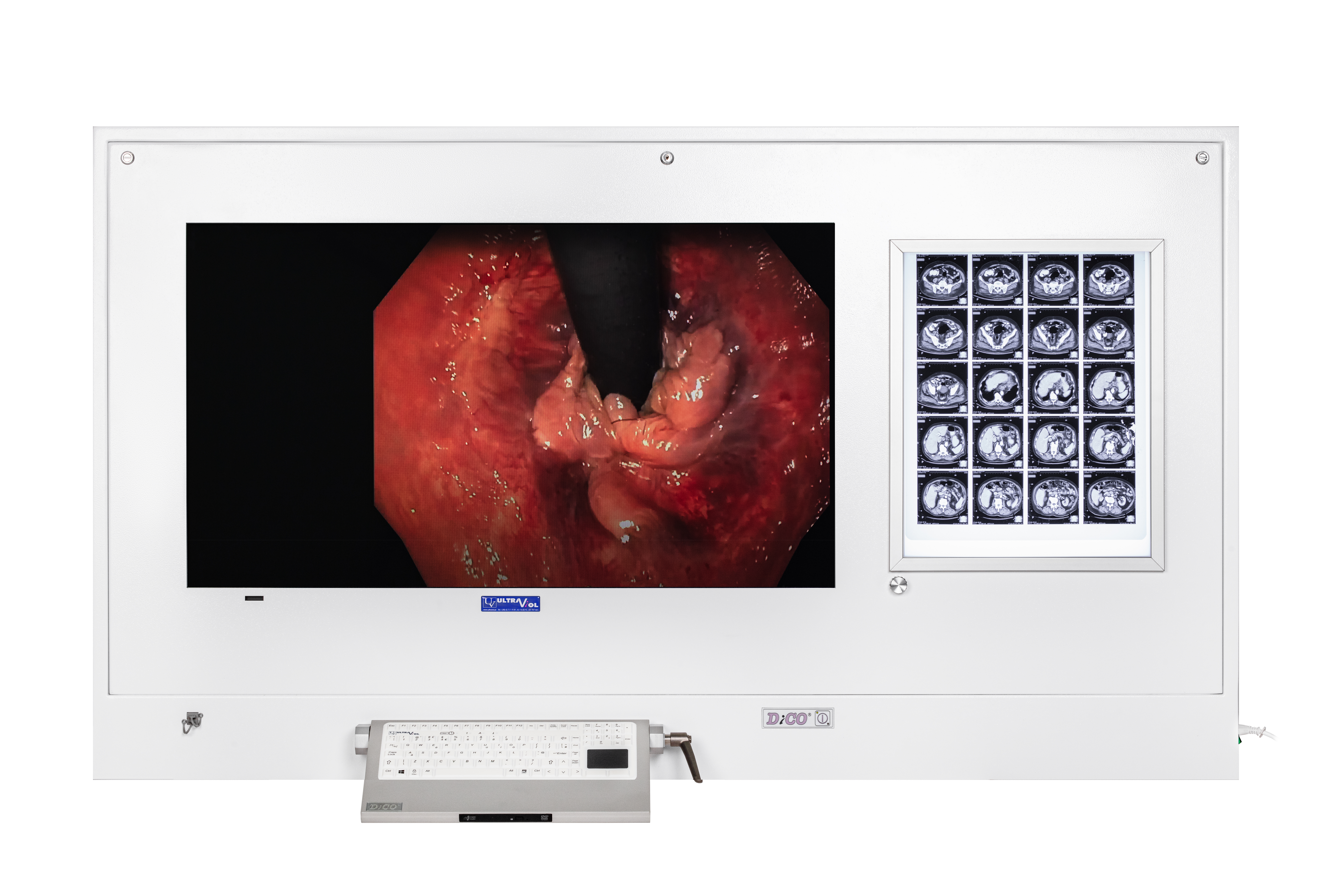 Stacje przeglądowe obrazów medycznych na sale operacyjne ULTRAVIOL DICO 1M/1B 21" - STACJA PRZEGLĄDOWA CYFROWYCH OBRAZÓW MEDYCZNYCH